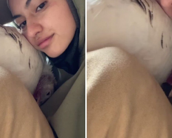 Rescued Turkey Can’t Stop Hugging The People Who Saved Her