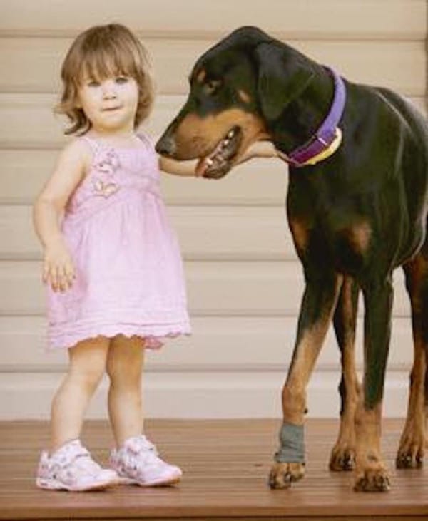 Doberman Saves A 17-Month-Old Toddler From A Deadly Snake 4