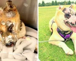 Burn Survivor Dog Ready To Give Back To Society, Becomes A Burn Unit Therapy Dog