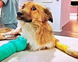 He Was Hit By A Car & Spent 3 Months Crawling In Pain With Shattered Bones