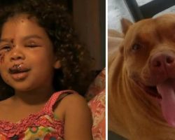 5-year-old gets bitten by neighbor’s labrador – this sets off the family pit bull who does the unimaginable