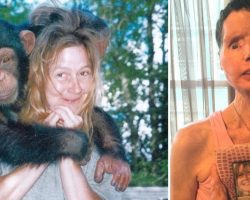 The Unthinkable Attack That Changed Charla Nash’s Life Forever