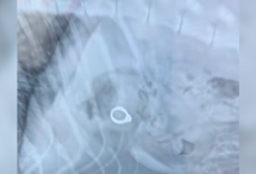 Vet Can’t Stop Laughing After Discovering What Happened To Woman’s Missing Engagement Ring