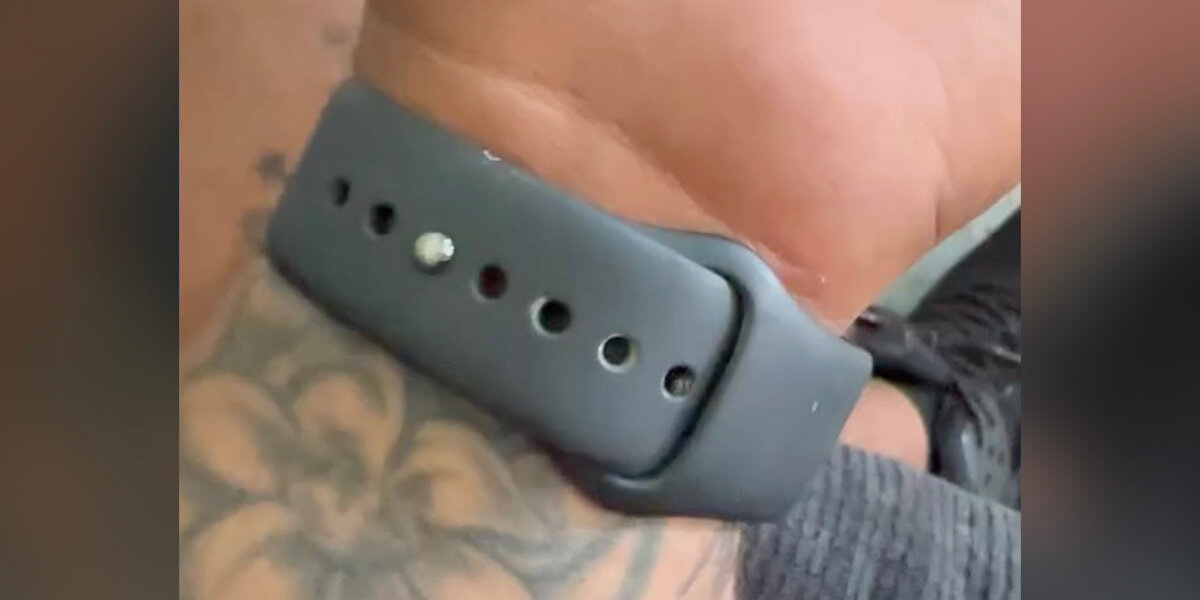Guy Looks Down And Finds A Tiny Roommate Living In His Watch Band